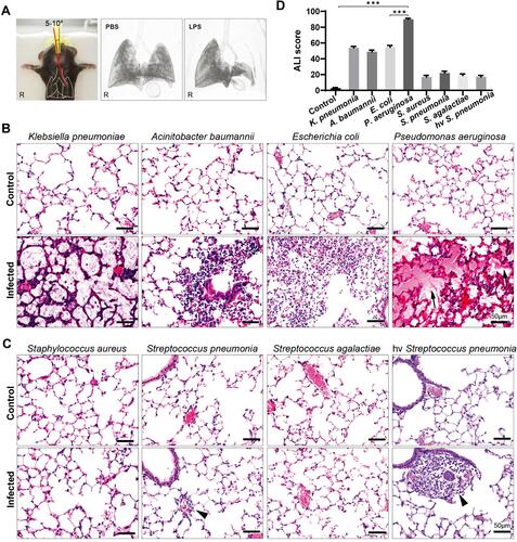 Figure 1 Histological assessment of acute lung injury induced by major bacterial species separated from clinical sputum (A) Unilateral endotracheal intubation. Unilateral lung consolidation appeared 4 hours after LPS instillation (3D CT reconstruction). (B) Hematoxylin and eosin (HE) stain of lung sections inoculated with gram-negative bacteria. Alveolar injury was observed in all groups (n=9 in each group). K. pneumoniae: neutrophils were accumulated in the alveolar wall and the alveolar space was filled with bacteria; A. baumannii: patchy neutrophil infiltration; E. coli: diffuse neutrophil infiltration; P. aeruginosa: hemorrhage, diffuse alveolar damage, hyaline membranes (arrows), vessel congestion, alveolar wall thickening and neutrophil infiltration were all observed. (C) HE stain of lung sections of gram-positive bacterial infection. Neutrophil infiltration was found limited in the periarterial space (arrowheads) without causing alveolar damage, especially in hypervirulent (hv) Streptococcus pneumonia group (n=9 in each group). (D) Score of 7 major bacterial species induced ALI 24h post-inoculation in mice, compared with normal C57/BL6 mice (n=6 per group). ***P < 0.0005.