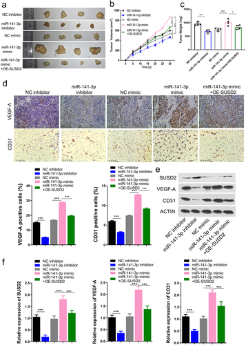 Figure 6. miR-141-3p promotes retinoblastoma growth and angiogenesis by targeting SUSD2 in vivo (n = 4). (a) Mass, (b) volume. (c) weights of the xenograft tumors. Key factor expressions by immunohistochemistry (d), Western blot assay (e), and qRT-PCR (f) analysis. **P < 0.01 and ***P < 0.001.