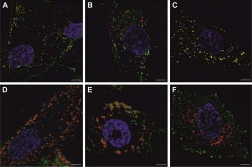 Figure 2 The SR-SIM analysis of hBM-MSCs with intracellular structures visible inside the cells positively stained with lypophilic dyes PKH26 (A–C) or tagged with superparamagnetic iron nanoparticles conjugated with rhodamine (Molday ION) (D and E) (red).Notes: Coexpression of tetraspanins (exosome markers), such as CD9 (A and D), CD63 (B and E), and CD81 (C and F) (green), was demonstrated. Cell nuclei were stained with Hoechst (blue). Scale bar =50 μm.Abbreviations: hBM-MSCs, human bone marrow mesenchymal stem cells; SR-SIM, super-resolution structured illumination microscopy.
