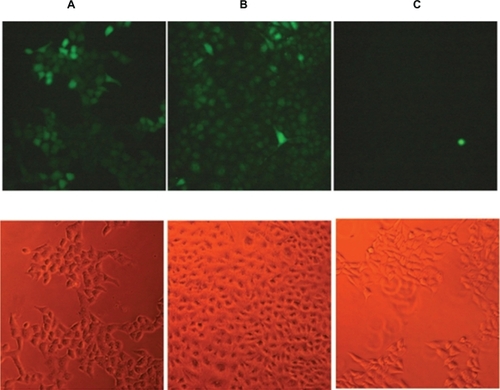 Figure 5 Detection of intracellular reactive oxygen species in (A) SH-SY5Y treated with tert-butyl hydroperoxide, a common inducer of reactive oxygen species (positive control), (B) SH-SY5Y treated with zinc oxide nanoparticle-modified culture medium (15 μg/mL), (C) SH-SY5Y treated with culture medium added with Arabic gum 0.075%. Top images: oxidative stress is represented by green fluorescent cells. Bottom images: bright field. (n = 3). Scale bar: 10 μm.