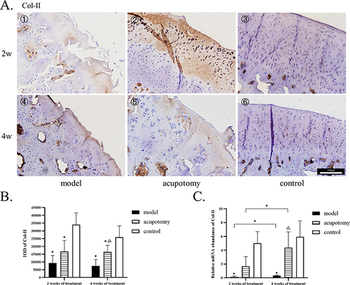 Figure 5 (A) 1–6: The immunohistochemistry staining of Col-II; Col-II staining of the model group, acupotomy group, and control group depicted from less to more. All pictures use the scale in the image ⑥. (B) Quantitative analysis of the IOD of Col-II. (C) The mRNA levels of Col-II. Compared with the control group during the same time period, *P is < 0.05; Compared with the model group during the same time period, ΔP is < 0.05.