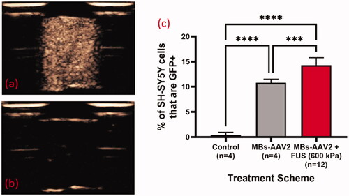 Figure 5. AAV2/eGFP conjugated MBs with FUS results in enhanced transduction of SH-SY5Y cells with eGFP. Contrast enhanced images of MBs-AAV2/eGFP (a) before FUS exposure and (b) post FUS exposure (600 kPa) demonstrating bubble destruction due to lack of contrast. (c) Destruction of MBs-AAV2/eGFP still retains ability to transduce SH-SY5Y cells. It should be noted that there was a significant increase in the transduction of cells when MBs-AAV2/eGFP were destroyed with FUS versus MBs-AAV2/eGFP that was not treated with FUS. Mean and standard deviations of the mean are plotted. ***p < 0.0005. ****p < 0.0001. MBs: microbubbles; AAV: Adeno-associated virus; FUS: focused ultrasound.