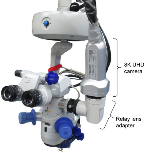 Figure 1 Our new 8K UHD camera mounted on a surgical microscope with a relay lens adapter.