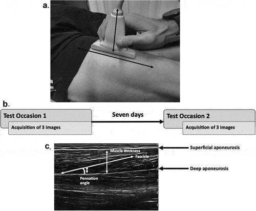Figure 1. Experimental design and procedures used to assess bicep femoris long head fascicle length. A. Image acquisition using 10-cm ultrasound probe, with probe-oriented perpendicular to the skin following the line of the bicep femoris (ischial tuberosity to lateral epicondyle). B. Experimental design with a timeline of test occasions and image acquisition. C. Example of sonogram image obtained of the bicep femoris with architectural features identified (muscle thickness, pennation angle, fascicle and aponeuroses (deep and superficial)).