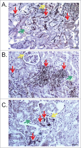 Figure 6. Kidney lesions in the murine model caused by T. asahii 07 (A), T. asteroides 01 (B) or T. inkin (C) infections 6 days after challenge. Kidney transversal sections showing hyphae, blastoconidia and arthroconidia (red arrows) in renal tubules (green arrows) and some of them in the glomerular structure (yellow arrows). GMS and hematoxylin stain. Bars, 20 μm. Magnification, x400.