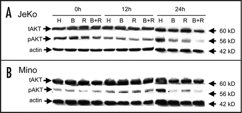 Figure 7 Bortezomib alone or in combination with rituximab induces Akt downregulation. Jeko (A) and Mino (B) cell lines were cultured in the presence of 10 nM bortezomib (continuous exposure) and/or rituximab (1 µg/ml), harvested at 0, 12 and 24 hours, and immunoblotted for total (tAkt) and phosphorylated Akt (pAkt) (H, herceptin; B, bortezomib; R, rituximab; B + R, bortezomib + rituximab).
