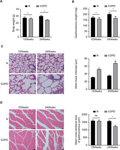 Figure 1 Chronic CS-induced emphysema and skeletal muscle atrophy in mice. (A) Body weight and gastrocnemius muscle (B) with or without CS exposure in mice. (C) Emphysema and skeletal muscle cross-sectional area (D) with or without CS exposure in mice. Data are representative images (magnification x 200) and expressed as the mean ± SD of each group (n=8) of mice. *p<0.05 vs control group (N).