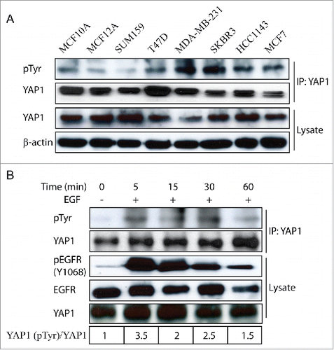 Figure 2. Examination of endogenous YAP1 tyrosine phosphorylation in breast cancer cells. (A) Expression of tyrosine-phosphorylated YAP1 and total YAP1 in a panel of breast cancer cells as examined by immunoblot. β-actin was used as a loading control. (B) Tyrosine phosphorylation of- YAP1 induced by EGF treatment in MCF10A cells.