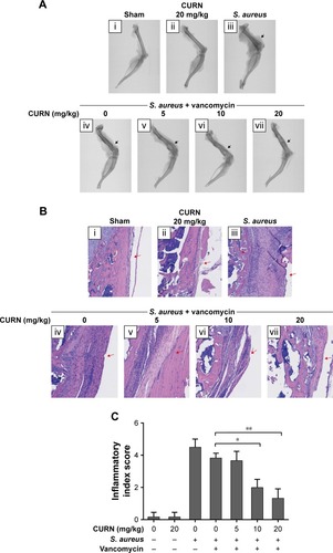 Figure 6 Evaluation of infection level in mouse femur.Notes: (A) Micro-CT images, in which black arrows indicate the grade of severity in bone destruction: (i) sham group, (ii) CURN only, (iii) permeative destruction with S. aureus implantation, (iv) pathologic fracture after vancomycin (2 mg/kg) treatment, and (v–vii) the less osteolytic size in the gradient concentration of CURN. (B) Histological analysis by H&E staining showed that CURN was effective for treating PJIs cotreated with vancomycin (2 mg/kg). The labeling of figures is the same as that of micro-CT images. Red arrows indicate infiltrating mononuclear immune cells. (C) The inflammatory index score was evaluated based on the levels of inflammatory cell infiltration in the femur (n=3 for each group). Red arrows indicate infiltrating mononuclear immune cells. Data are expressed as the mean ± SD. *P<0.05 and **P<0.01 compared to the group of S. aureus infection treated with vancomycin alone.Abbreviations: CT, computed tomography; CURN, curcumin nanoparticles; PJI, periprosthetic joint infection; S. aureus, Staphylococcus aureus.