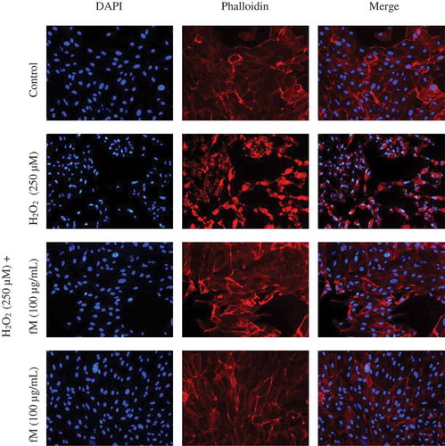 Figure 3. Effect of H2O2 on structural cellular aspects of ARPE-19 human cell line, and the retinoprotective effect of fraction M (fM) against H2O2-induced cell injury. Cells actin-microfilament cytoskeleton (red-colored) and nuclear DNA (blue-colored), after staining with phalloidin and DAPI, respectively. Observations were made at 20x. Control cells were incubated with DMSO as the vehicle solvent at a maximum concentration of 0.5% and represent no morphologic changes.Figura 3. Efecto de H2O2 sobre los aspectos celulares estructurales de la línea celular humana ARPE-19 y efecto retinoprotector de la fracción M (fM) contra la lesión celular inducida por H2O2. Citoesqueleto de actina y microfilamento de células (de color rojo), y ADN nuclear (de color azul), después de su tinción con faloidina y DAPI, respectivamente. Las observaciones se hicieron a 20x. Las células control se incubaron con DMSO como disolvente vehículo a una concentración máxima de 0.5% y no representan cambios morfológicos