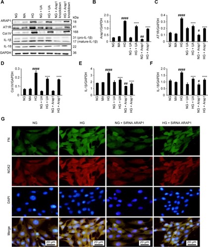 Figure 5 UA treatment and ARAP1 knockdown reduced mesangial cell inflammation, extracellular matrix protein expression, fibrosis and oxidative stress. (A) Changes in ARAP1, AT1R, Col IV, IL-1β and IL-18 protein levels detected by Western blotting. (B–F) Semiquantitative analysis of Western blotting results. (G) Changes in the expression of FN and NOX2 in each group as assessed using fluorescence microscopy (x200). #P<0.05, ##P<0.01, ####P<0.0001 compared with the NG group, and *p<0.05 ****p<0.0001 compared with the HG group.