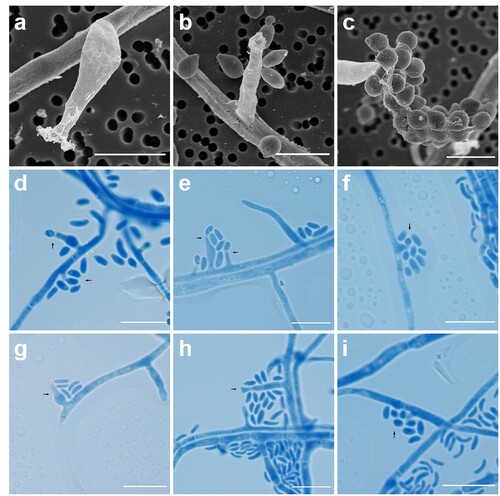 Figure 4. Microscopic features of Pleurostoma hongkongense HKU44T. Arrows indicate notable structures. (a–c) Scanning electron microscopy photographs of notable phialide and conidia features. Scale bars = 5 μm. (d–i) Bright-field microscopy of corresponding features using a slide culture preparation. Slides were prepared via wet mount and stained with lactophenol cotton blue (original magnification 1000×). Scale bars = 10 μm.