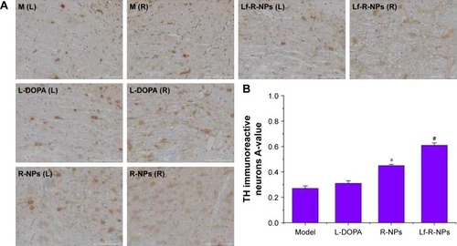 Figure 4 TH expression by immunostaining in the substantia nigra.Notes: (A) Representative images of TH immunostainng in the substantia nigra; (B) Data were analyzed by counting the relative optical density value (A-value) using Image-Pro Plus 6.0 software. The A-value are expressed as mean ± SD (n=5). *P<0.05 compared with L-DOPA group. #P<0.05 compared with R-NPs group. Scale bar = 1,000 μm.Abbreviations: L-DOPA, levodopa; R-NPs, rotigotine nanoparticles; TH, tyrosine hydroxylase; M, model; L, left; R, right.