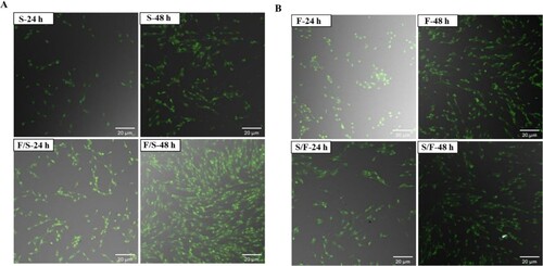 Figure 7. Morphological features in the mono- and co-culture porcine using AO/EtBr double staining with confocal microscopy (n = 3). (a) Satellite cells. Here, S-24: monoculture satellite cells 24 h incubation; S-48: monoculture satellite cells 48 h incubation; F/S-24: co-culture satellite cells 24 h incubation; and F/S-48: co-culture satellite cells 48 h incubation. (b) fibroblasts. Here, F-24: monoculture fibroblast cells 24 h incubation; F-48: monoculture fibroblast cells 48 h incubation; S/F-24: co-culture fibroblast cells 24 h incubation; and S/F-48: co-culture fibroblast cells 48 h incubation. Passage number of both cells were 6 in this experiment.