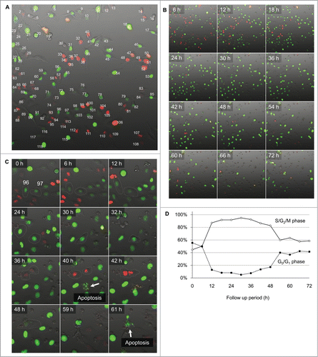 Figure 4. Single cell time-lapse imaging of HeLa-FUCCI cells after irradiation with 200 J/m2 UVB. (A) Individualization of cancer cells. Each cell was individualized by numbering. The cell-cycle phase of each cell was observed every 30 min for 72 hours by confocal microscopy imaging. (B) Time-lapse imaging of the cell-cycle phase and apoptosis after irradiation with 200 J/m2 UVB. (C) Apoptosis after irradiation with 200 J/m2 UVB. Cell 96 entered apoptosis after mitosis. Cell 97 cell became apoptotic without mitosis. (D) Distribution of cell-cycle phase after irradiation with 200 J/m2 UVB.
