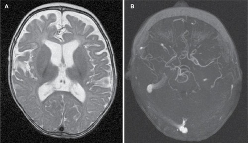 Figure 3 Radiologic findings.