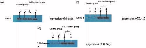 Figure 3. The cytokine expression results of western blot: IL-12 and IFN-γ expression has been proved by western blotting analysis. One sample of each group has been showed in picture. (A) expression of β-actin. (A) Proteins were equalized by use of β-actin expression. (B) expression of IL-12. (B) Western blotting results showed that IL-12 expression was enhanced in group treated with IL-12 incomparable to control group. (C) expression of IFN-γ. (C): Western blotting results showed that IFN-γ expression was enhanced in group treated with IFN-γ incomparable to control group.