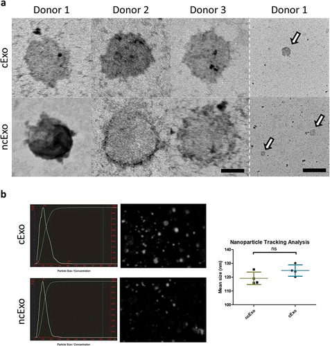 Figure 4. Electron microscopy and nanoparticle tracking analysis. (a) Transmission electron microscopy revealed a rounded appearance from both groups of exosomes. (b) Nanoparticle tracking analysis showed a mean size of around 125 nm with no difference between the two groups (n = 4). Scale bar = 50 nm (left) and 500 nm (right).