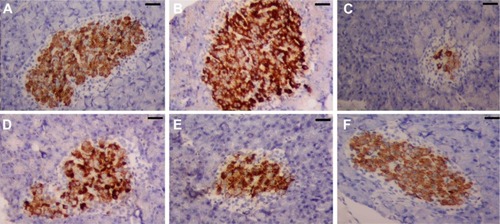 Figure 12 Rat pancreas stained with insulin antibody.Notes: (A) Control group, showing β-cells in the islet of Langerhans that are strongly stained with the anti-insulin antibody. (B) SeNPs group, showing β-cells in the islet of Langerhans that are very strongly stained with the anti-insulin antibody. (C) STZ group, weak insulin-immunoreactivity is observed in a few β-cells in the islet of Langerhans in diabetic rats. (D) STZ-SeNP-treated group, SeNPs has protected the majority of β-cells in the islet of Langerhans, and strong staining with the anti-insulin antibody is shown. (E) STZ-Ins-treated group, insulin has protected the few of β-cells in the islet of Langerhans, and moderate staining with the anti-insulin antibody is shown. (F) STZ-SeNPs-Ins-treated group, SeNPs, and insulin has protected the majority of β-cells in the islet of Langerhans, and strong staining with the anti-insulin antibody. Scale bar =50 μm.Abbreviations: Ins, insulin; SeNPs, selenium nanoparticles; STZ, streptozotocin.