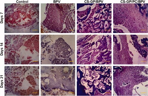 Figure 12. Histopathological evaluation of the anti-inflammatory effects of BPV-loaded CS-GP hydrogel and CS-GP/PC polymeric hydrogel on 7, 14, and 21 days were stained with hematoxylin and eosin (H&E) (scale bar = 100 μm).