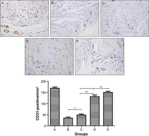 Figure 3 Angiogenesis in the peri-infarct area.