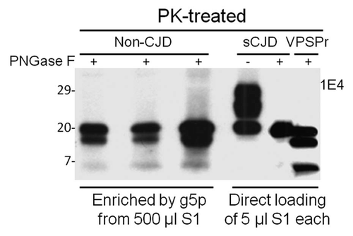 Figure 2 Comparison of PK-resistant PrP core fragments from non-CJD, VPSPr and sCJD. PrP captured with g5p from brain homogenates of three non-CJD subjects was treated with PK and PNGase F prior to SDS-PAGE and immunoblotting with anti-PrP antibody 1E4. Fifty µl of insoluble fraction (P2) equivalent to 500 µl of supernatant (S1) from a low-speed centrifuge was used for each non-CJD subject. In these highly concentrated samples from non-CJD subjects, three PK-resistant PrP (PrPres) fragments migrating at ∼20 kDa, ∼17–18 kDa and ∼6–7 kDa were detected with 1E4. But these PrPres fragments were not detectable by 3F4 (data not shown). In contrast, three PrP fragments with similar gel mobility were also detected in only 5 µl of S1 preparation from a VPSPr case (129MV) by 1E4 after treatment with PK and PNGase F. However, only one PrP band was detected in sCJD samples after PK and PNGase F treatment.