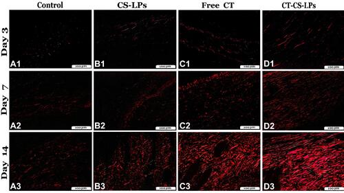 Figure 10 Photomicrographs of skin sections from all studied groups stained with Picrosirius red stain (polarized-field view), on the 3rd, 7th, and 14th days post wound creation showing: control (A1–A3), CS-LPs (B1–B3), Free CT (C1–C3) and CT-CS-LPs (D1–D3) groups. The shiny red fibers were the mature collagen, while the immature appeared light green.