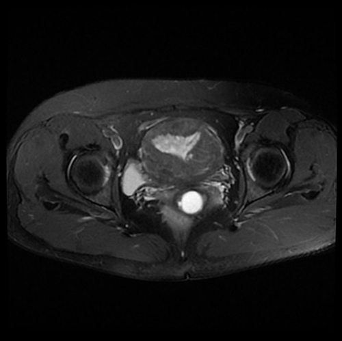 Figure 1 2018.07.26 MRI.