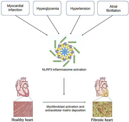 Figure 2 NLRP3 inflammasome activation in cardiovascular diseases to promote cardiac fibrosis. Under pathological conditions, such as myocardial infarction, hypertension, and hyperglycemia, atrial fibrillation, NLRP3 inflammasome in cardiomyocytes and fibroblasts are activated, collaboratively promoting the inflammatory cascade and pyroptosis. The resultant cardiac inflammation triggers myofibroblast activation and cardiac fibrosis.