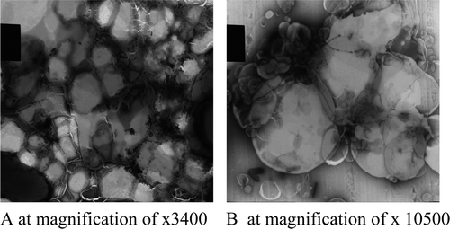 Figure 1.  Transmission electron microscope images of the liposome-encapsulated ND vaccine.