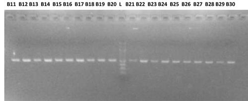 Figure 2 Polymerase chain reaction amplicons of Sample B11 – B30: All PCR gene amplicons appeared at 500bp, using a 100bp DNA molecular ladder.
