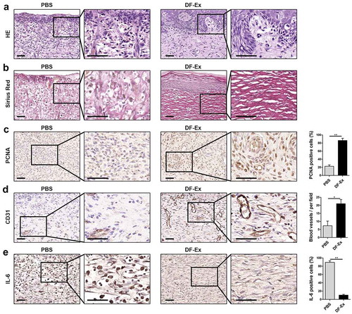 Figure 4. Histological analysis of diabetic cutaneous wound healing at day 15. (a) HE staining was used to detect skin structure in the wounds. (b) The distribution of collagen fibers in skin tissues was analyzed through Sirius Red staining. (c) IHC was used to detect the expression level of PCNA in the wounds. (d) IHC was used to detect the expression level of CD31 in the wounds. (e) IHC was used to detect the expression level of the inflammatory cytokine IL-6 in the wounds. (a–e) Sections in the rectangle are magnified on the right, scale bar = 50 μm. (c–e) n = 3, *p < 0.05, **p < 0.01