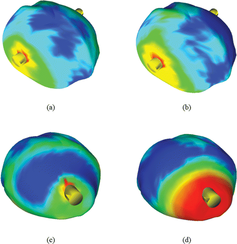 Figure 9. Temperature field illustrated on the surface of the reconstructed prostate, where blue represents areas with temperatures below −45°C, green represents 0°C, and red represents 37°C: (a) front view of pullback case; (b) front view of non-pullback case; (c) back view of pullback case; and (d) back view of non-pullback case, all for prostate model B. [Color version available online.]