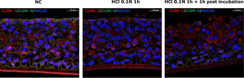 Figure 4 Immunofluorescence analysis of CLDN-1 and CLDN-4 double staining in untreated HO2E/12 tissues (NC) and HO2E/12 exposed to HCl 0.1N (pH 1.2) for 1h without (series HCl 0.1N 1h) or with 1h post incubation period (series HCl 0.1N 1h + 1h post incubation). Nuclei are stained in blue (DAPI). Magnification 63x. Scale bar = 30 μm. Representative images selected within triplicate series.