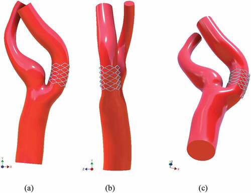 Figure 3. Stented model with stenosis removed; (a) front view (b) side view (c) perspective bottom view.