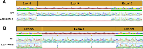 Figure 3 Sequencing chromatogram of SLC12A3 wild-type cDNA and splice variants. (A) The normal splicing fragment between exon 8 and 10; aberrant transcript of c.1096–2A>G skipping of exon 9. (B) The normal splicing fragment between exon 22 and 24; aberrant transcript of c.2747+4del skipping of exon 23.