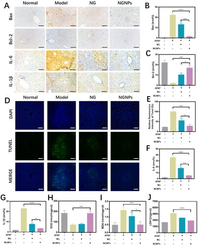 Figure 8. Anti-inflammatory, anti-apoptotic and anti-oxidative effects of NGNPs in vivo. (A) The Bax, Bcl-2, IL-6 and IL-1β immunohistochemical staining of liver tissue in each group mice. The (B) Bax, (C) Bcl-2 positive field portion in each group mice. (D) The TUNEL fluorescence staining and (E) corresponding semi-quantitative statistics of Tunel levels. The positive field portion of (F) IL-6 and (G) IL-1β in liver tissue of mice in each group. The levels of (H) SOD, (I) MDA and (J) LDH of liver in each group mice. Scale bar = 100 μm. *P < 0.05, **P < 0.01, ***P < 0.001, ****P < 0.0001.