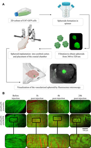 Figure 3 Vascular selectivity using the cranial chamber model with U87-GFP spheroid and fluorescence imaging. (A) Experimental protocol illustrating spheroids formation (U87-GFP cells grown in non-adherent flasks were transferred to a spinner placed on a magnetic stirrer for 4 days to form spheroid), their filtration and implantation onto the cerebral cortex of nude mice. A glass window was placed on the skull allowing visualization of the tumor tissue and its vasculature at about 10 days after xenotransplant. Mice were divided into two batches: AGuIX@PS@KDKPPR or AGuIX@PS@scramble group. Visualization of different nanoparticles into the vasculature was performed on anesthetized mice. Blood vessels are observed in black and PS fluorescence in red. (B) The vascular network was imaged before, 1, 6 and 24h after i.v. injection of nanoparticles (4 μmol.kg−1, porphyrin equivalent). The excitation filter was at 560 ± 25 nm and at 475 ± 20 nm for PS and GFP-U87 fluorescent images acquisition, respectively. The emission filter was composed with a block of four emission filters at 440, 521, 607 and 700 nm. Photos taken with the same magnification; scale bar represents 100 µm.