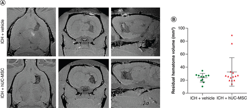 Figure 4. Evaluation of the residual hematoma volume.Animals were treated with (ICH + hUC-MSC) or with the vehicle (ICH + vehicle) 1 h after the induction of ICH. (A) Representative T1-weighted images obtained with a 3D sequence in a 2 Tesla MRI scanner 22 days after the induction of ICH. (B) Graph showing the quantification of the residual hematoma volume. Data shown in the graphs are individual values, and means ± SD Mann–Whitney U test; n = 11 (ICH + vehicle) and n = 14 (ICH + hUC-MSC) rats per group.hUC-MSC: Human umbilical cord-derived mesenchymal stromal cells; ICH: Intracerebral hemorrhage.