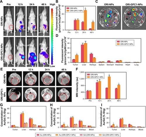 Figure 6 In vivo NIRF/MRI and ICP-MS.Notes: (A) In vivo NIRF images and (B) their fluorescent intensity of tumor-bearing nude mice at specified times after injection of ORI-NPs or ORI-GPC1-NPs. (C) Ex vivo NIRF images (Organs: 1. Tumor, 2. Liver, 3. Kidneys, 4. Spleen, 5. Stomach, 6. Intestine, 7. Heart, 8. Lung) and (D) fluorescent intensity of tumor and major organs at 48 hours after injection of ORI-NPs and ORI-GPC1-NPs. Organs: tumor, liver, kidneys, spleen, stomach, intestines, heart, and lung. (E) In vivo MR images and (F) MRI intensity of tumor- bearing nude mice at specified times after injection of ORI-NPs or ORI-GPC1-NPs. Au and Gd concentrations in tumors and major organs were measured by ICP-MS at (G) 12 hours, (H) 24 hours, and (I) 48 hours. *P<0.05, for ORI-NPs vs ORI-GPC1-NPs.Abbreviations: Au, gold; Gd, gadolinium; ICP-MS, inductively coupled plasma mass spectrometry; MR, magnetic resonance; MRI, magnetic resonance imaging; NIRF, near- infrared fluorescence; ORI-NPs, Gd-ORI@HAuNCs-Cy7 nanoparticles; ORI-GPC1-NPs, GPC1-Gd-ORI@HAuNCs-Cy7 nanoparticles.
