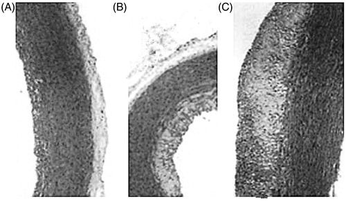 Figure 3. Microscographs of HE staining on rabbit thoracic aorta (100 ×): (A) normal group, (B) 240 mg/kg geniposidic acid group, and (C) model control group.