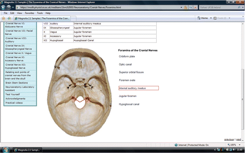 Figure 3. Neuroanatomy CAL Web page containing an interactive diagram. Footnote: Moving the mouse over one of the labels creates arrows pointing to the relevant part on the diagram.