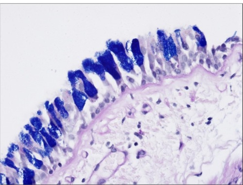 Figure 3 Goblet cell hyperplasia.