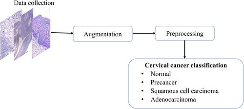Figure 2 Block diagram of the cervical cancer classification system.