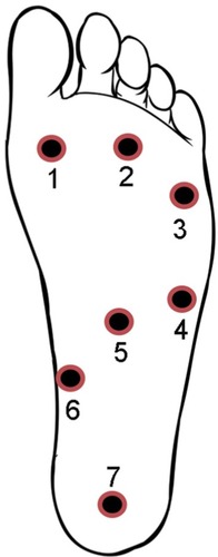 Figure 6 Points of assessment for topographical pressure pain sensitivity maps of the foot.