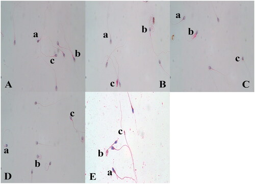 Figure 1. Evaluation of sperm morphology using Papanicolaou staining method. (A) Morphology of spermatozoa after incubation in the control group; a) small head, b) thick mid-piece, c) mid-piece and acrosome abnormality, (B) Morphology of spermatozoa after incubation in the 1% PRGF group; a) doubled tail, b) thick mid-piece, c) excess residual cytoplasm, (C) Morphology of spermatozoa after incubation in the 5% PRGF group; a) thick mid-piece, b) excess residual cytoplasm, c) amorphous head, (D) Morphology of spermatozoa after incubation in the 10% PRGF group; a) low acrosome area and coiled tail, b) coiled tail, c) thick mid-piece, (E) Morphology of spermatozoa in raw semen, a) excess residual cytoplasm, b) coiled tail, c) small head (×1,000).
