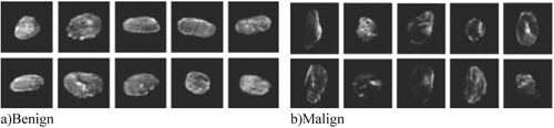 Figure 12. Results of synthetic thyroid nodule images for each class. (a) Benign and (b)malign.