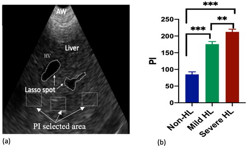 Figure 5. (a) US image processing in Adopephotoshop software, 3 designated square in each image represent the selected area of measurement, lasso spot was used to mark the outlines of the artefacts or blood vessels. (b) PI values of the hepatic US images from the study groups. The severe HL group had higher PI values than did the mild HL and non-HL groups. (**) represents p < 0.01, and (***) represents p < 0.001. Abbreviations: PI: pixel intensity; US: ultrasound; HL: hepatic lipidosis.