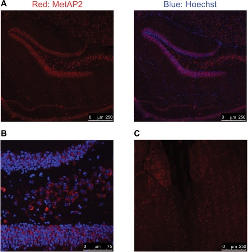 Figure 6 MetAP2 expression in neurons in the brain obtained from DIO mice. Notes: (A, B) MetAP2 immunofluorescence in hippocampal neurons. (C) MetAP2 immunofluorescence in the cortex of the front lobe. Magnification ×20.