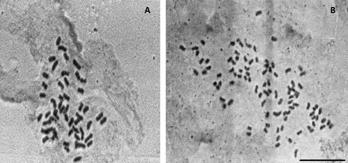 Figure 3 Mitotic metaphases in Mimosa biucifera (a tetraploid species) with (A) 52 chromosomes and (B) 104 chromosomes. Scale bar 10 μm.